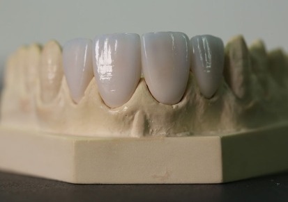矫治器工厂 MRC 保持器 矫正器 牙套厂家 3D打印矫正器工厂 透明牙套