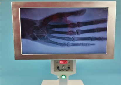 一种观察窗10.4英寸的可用于正骨复位的便携式X光机