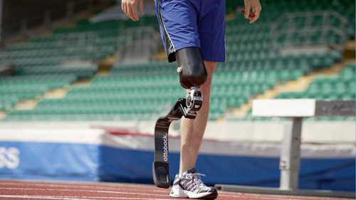 下肢矫形器定制 无锡下肢矫形器 马鞍山德康假肢公司 