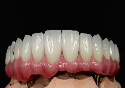 矫治器工厂 MRC 保持器 矫正器 牙套厂家 3D打印矫正器工厂 透明牙套