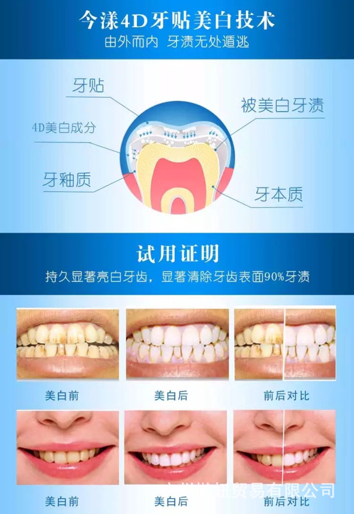 牙贴副图4