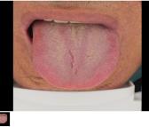中医实训设备 舌象仪 道生 监测身体情况学习舌苔状态诊断
